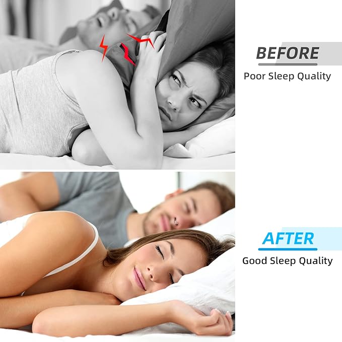 Anti Snoring Ring Device